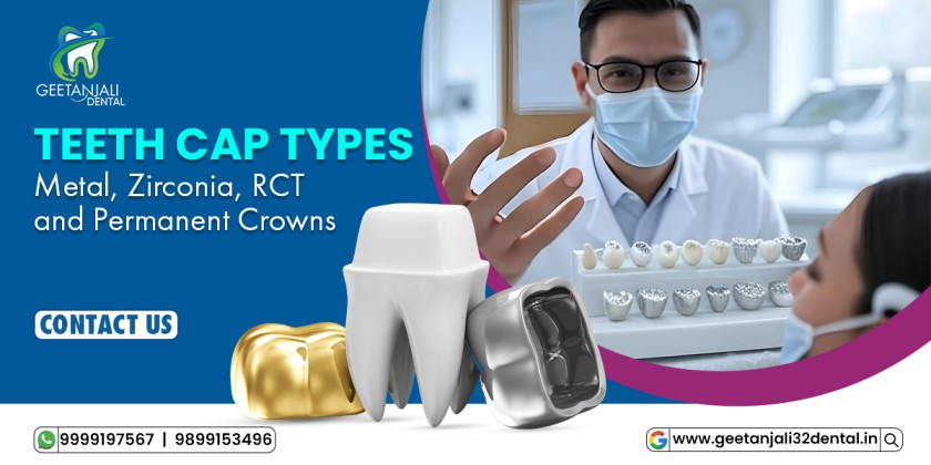 Teeth Cap Types: A Complete Guide to Metal, Zirconia, RCT, and Permanent Crowns